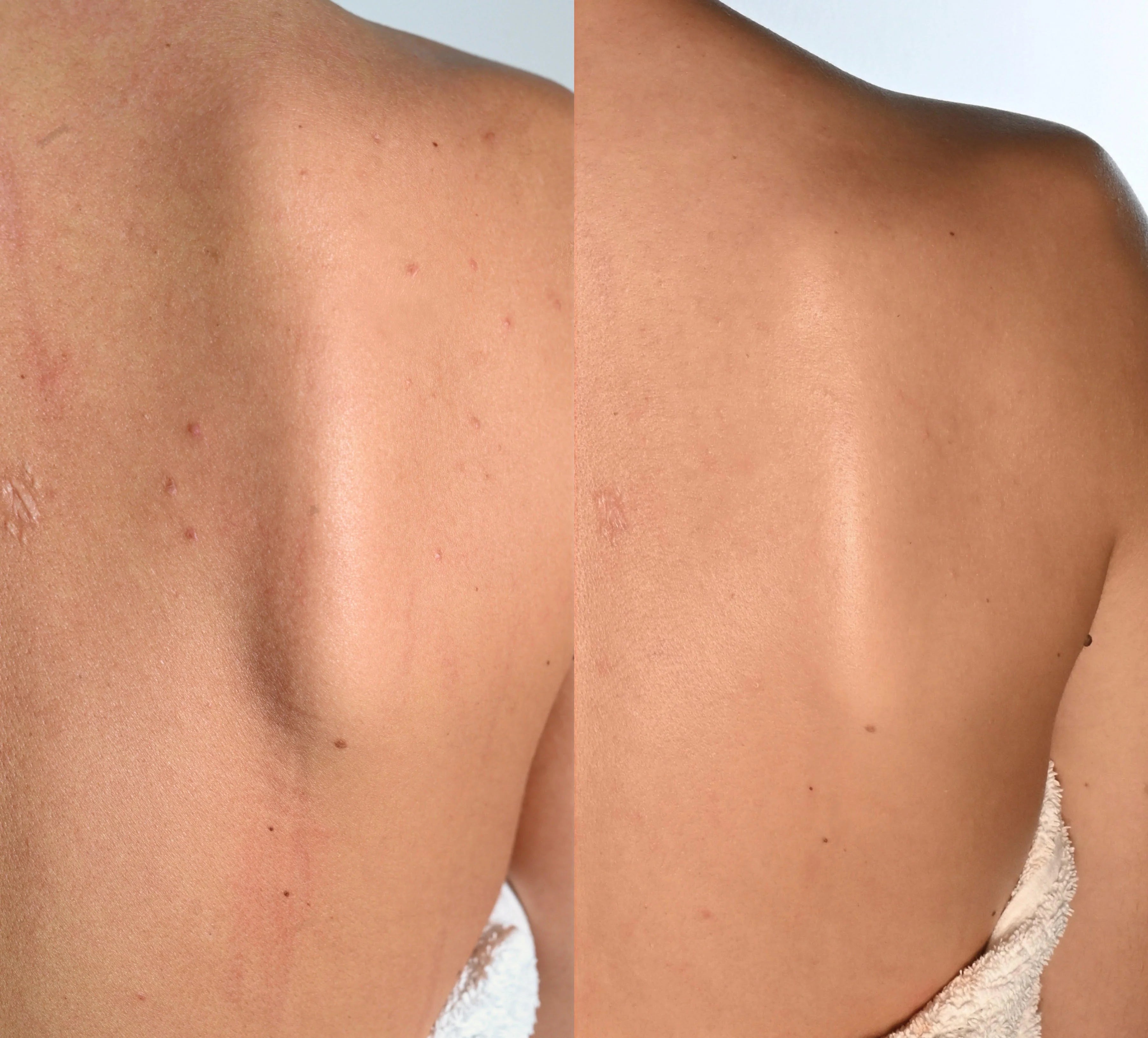 Back Scrubber - Amami - Skin Care.